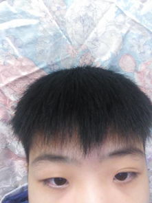 揭秘男生下头长疙瘩：原因与应对策略