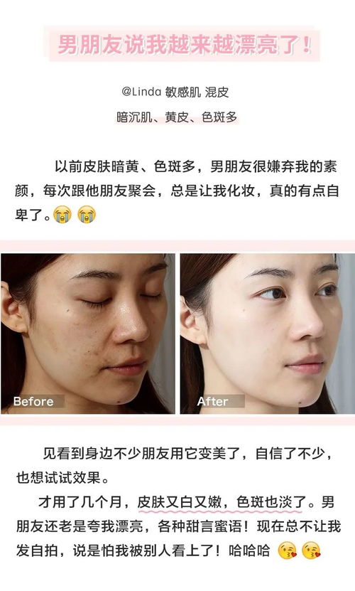 《女性肝火上升：揭秘原因与缓解策略》