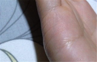 《婚姻线中的神秘错位：揭秘预示着什么？》