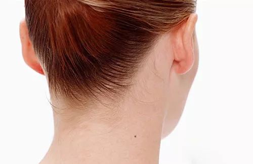 女人人中上头有痣，美丽加分还是运势减分？