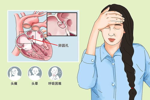 头痛成“挡箭牌”？揭秘女生用头痛拒绝约会的真相