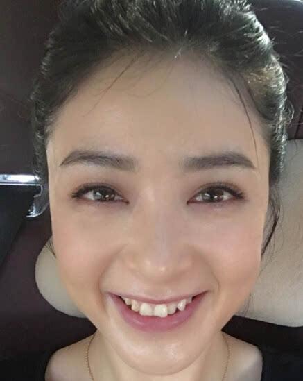 如何优雅回应女生“容忍不了瑕疵”的烦恼？