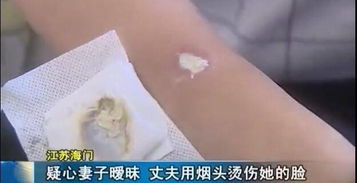 《伤疤痛，出轨老婆：如何走出婚姻困境？》